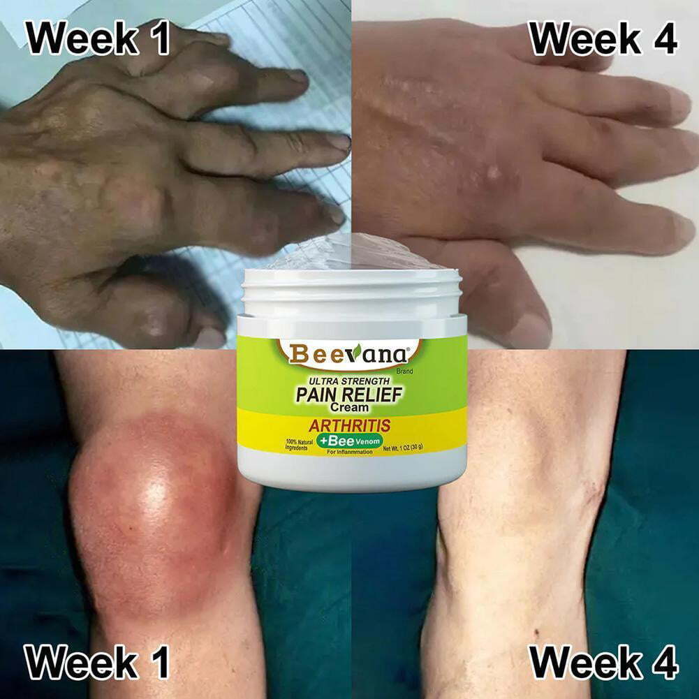 Bee-Venom Gold Pain-Relief Bone Healing Cream